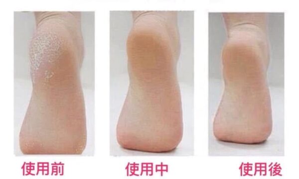 DUIT 急救5日見效腳膜腳霜2入組(50ml*2)：圖片 6